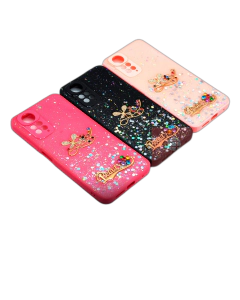 Xiaomi Redmi Note 11 4G Back Cover Shine Glitter Beauty Redmi Note 11 Case For Girls
